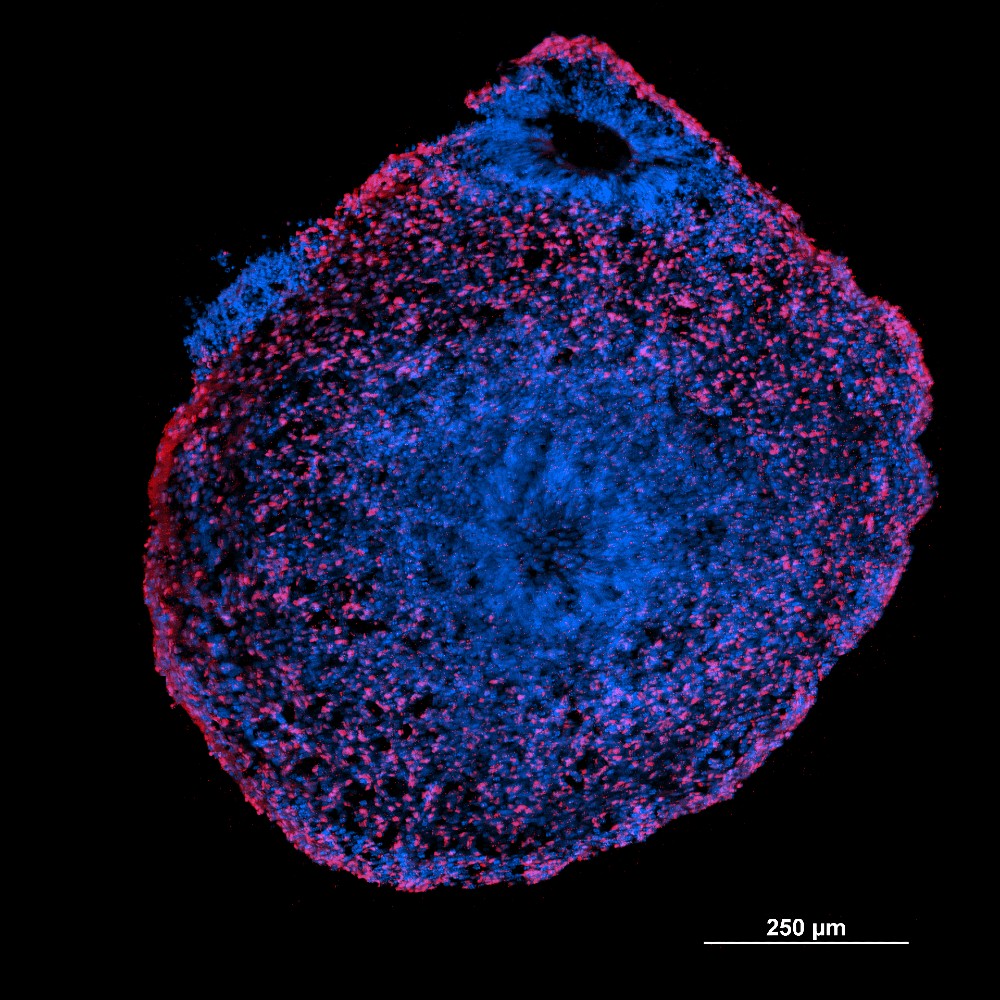CICERO spinning disk